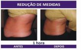 Aloe Body Tonight Kit - Tratamento para redução de medidas