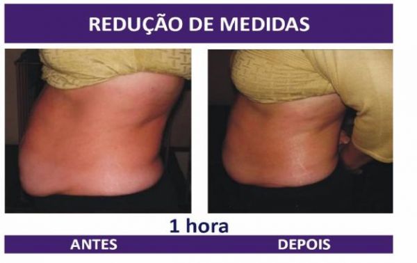 Aloe Body Tonight Kit - Tratamento para redução de medidas